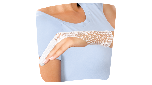 Imagen de una mujer joven con una herida en el dedo índice de la mano izquierda tapada con una gasa y una venda tubular. Imagen de una mujer joven con una herida en el dedo índice de la mano izquierda tapada con una gasa y una venda tubular.